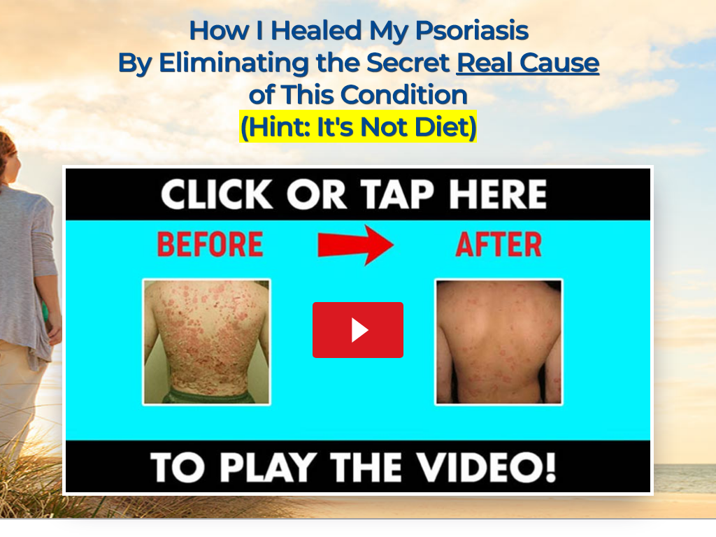 PSORIASIS REVOLUTION REVIEW – MY DAILY USE FOR 6 MONTHS
