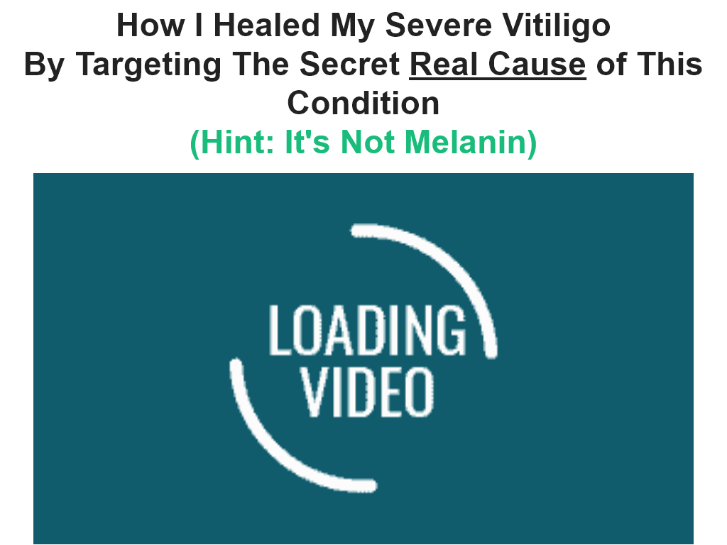 VITILIGO MIRACLE REVIEW | I ALMOST QUIT ON DAY 5 (READ WHY)